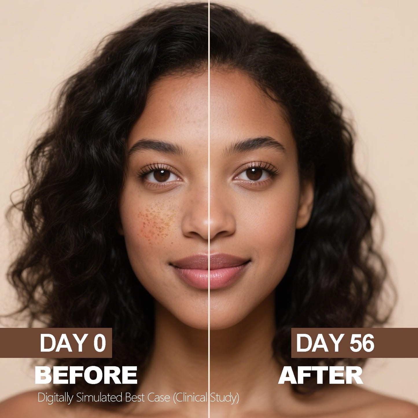 SINPIN aobenz Dark Spot Remover