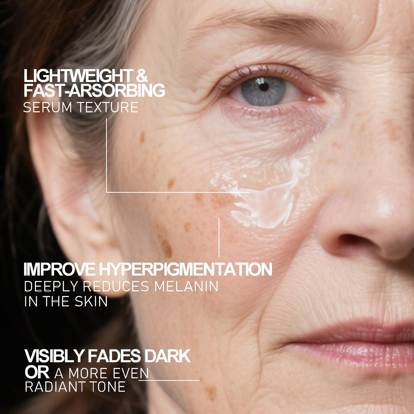 SINPIN aobenz Dark Spot Remover