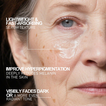 SINPIN aobenz Dark Spot Remover